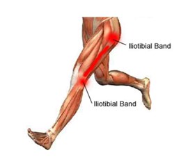 Knie