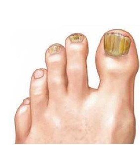 Nagels